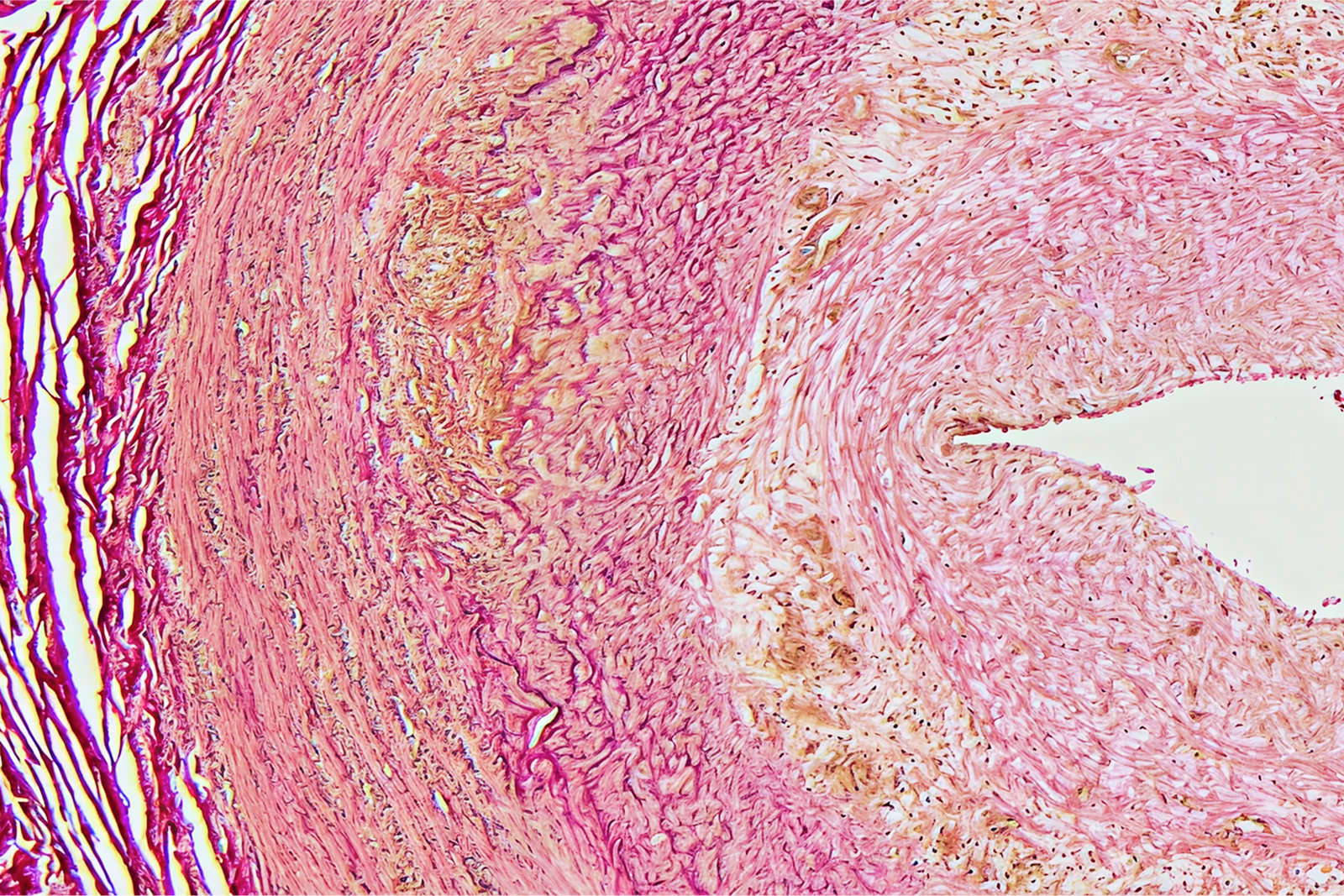 Mikroskopische Ansicht eines Gewebes mit rosa- und lilafarbenen Farbtönen, das eine kreisförmige Struktur zeigt.