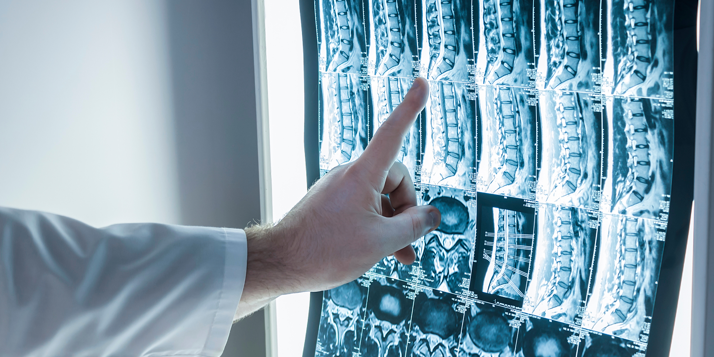 Ein Arzt zeigt mit dem Finger auf eine Röntgenaufnahme der Wirbelsäule.