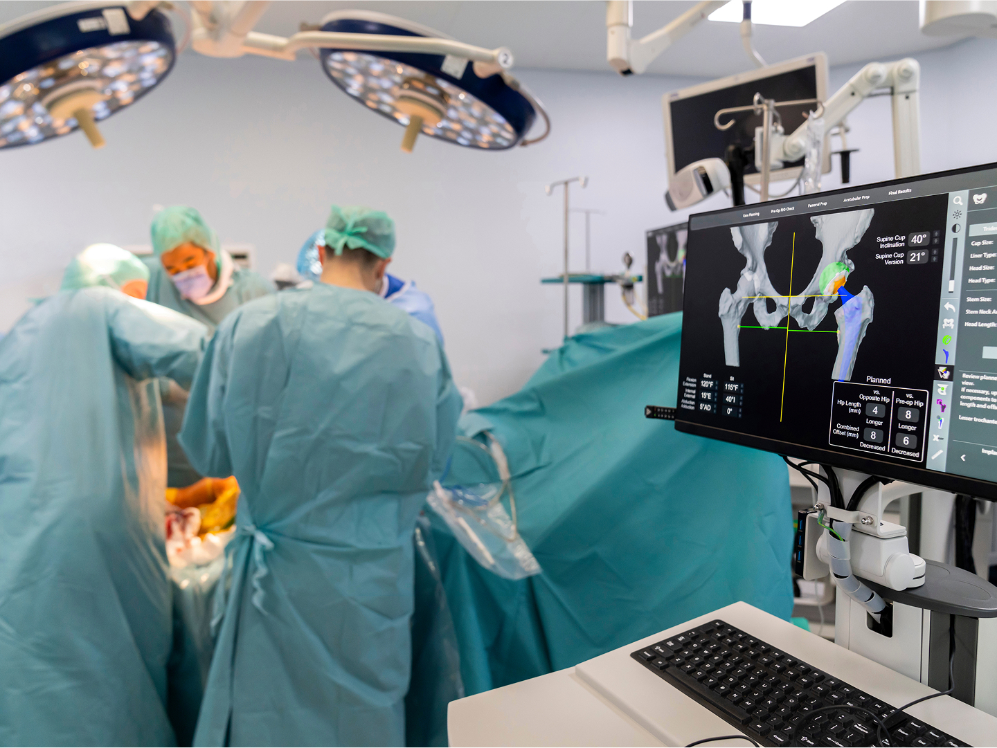 Chirurgisches Team in OP-Kleidung führt eine Operation durch, während ein Monitor im Vordergrund medizinische Daten anzeigt.