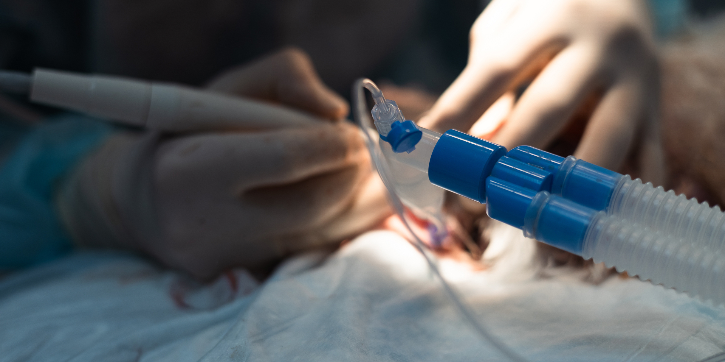 Zwei Hände in Operationshandschuhen halten ein chirurgisches Instrument über einem Patienten, während ein Schlauch mit blauen Verbindungen im Vordergrund sichtbar ist.