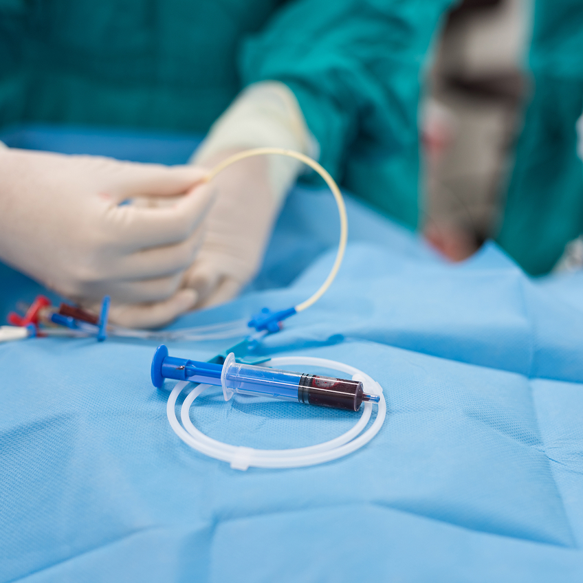 Eine Hand in Handschuhen hält einen Katheter, während eine Spritze mit Blut auf einem blauen Tuch liegt.