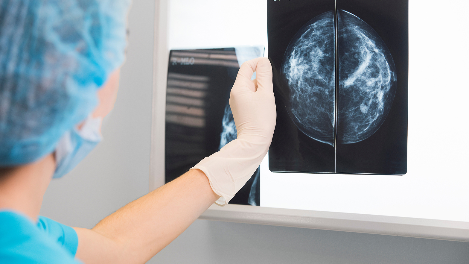Eine Person in medizinischer Kleidung betrachtet eine Mammografie auf einem Lichtkasten.