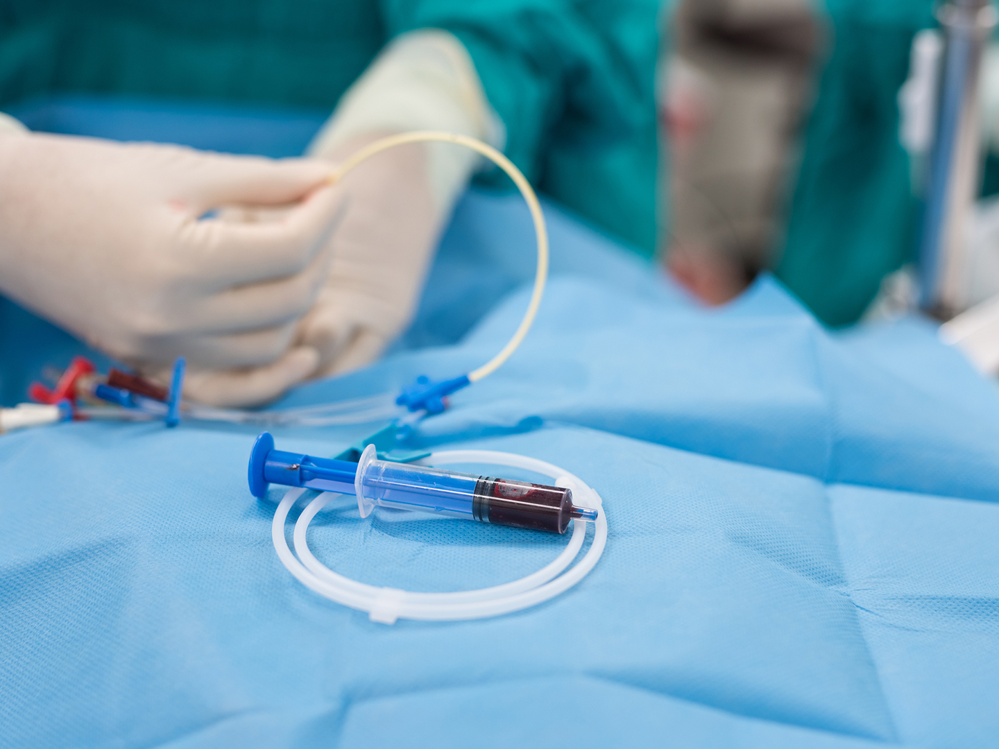Eine Hand in Handschuhen hält einen Katheter, während eine Spritze mit Blut auf einem blauen Tuch liegt.