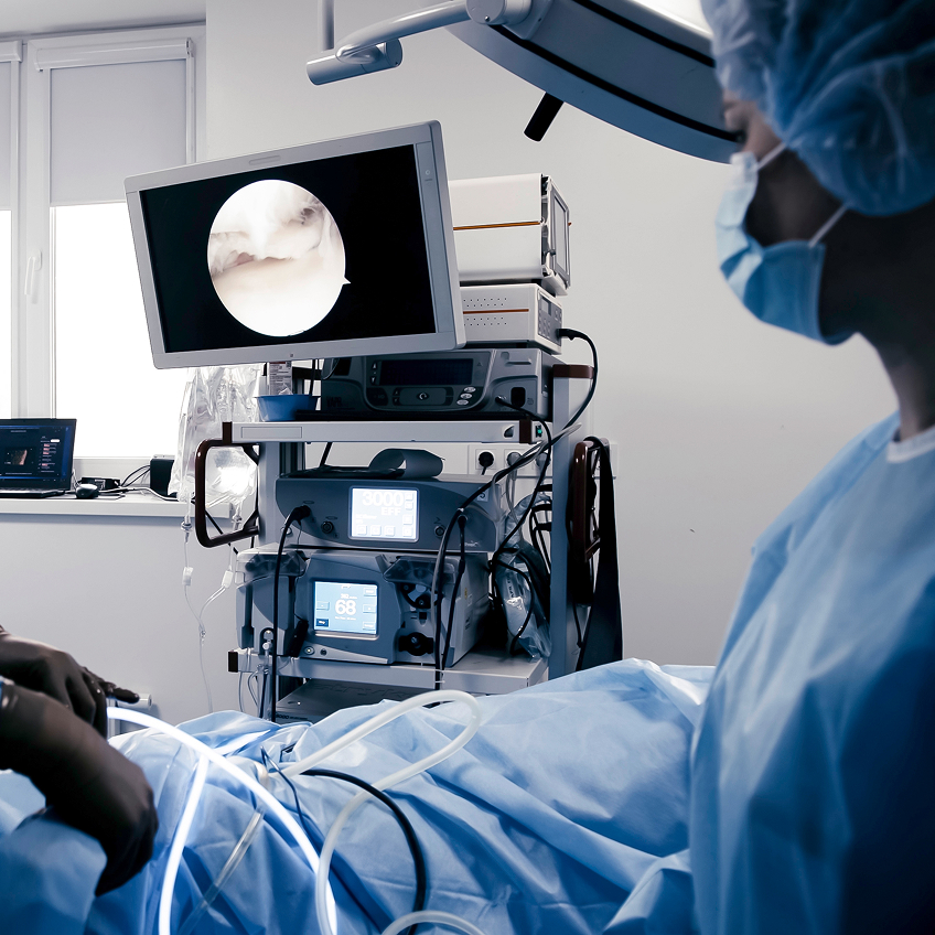 Chirurgisches Team bei einer Operation, Monitor zeigt einen Eingriff, medizinische Geräte im Hintergrund.