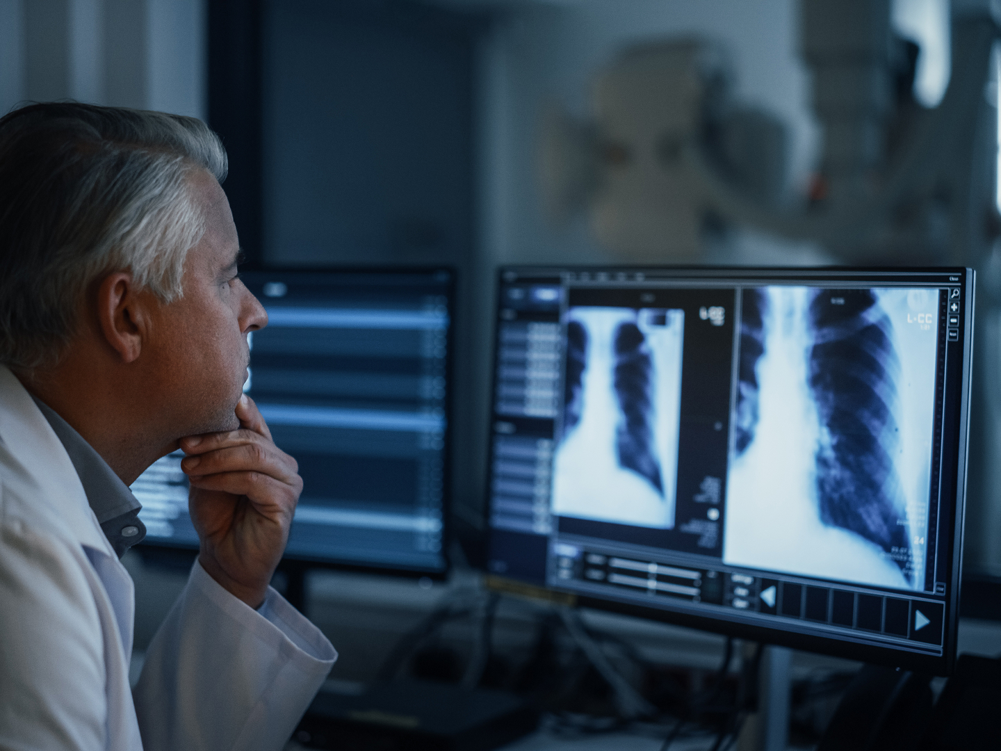 Ein Arzt betrachtet nachdenklich Röntgenbilder auf einem Monitor.