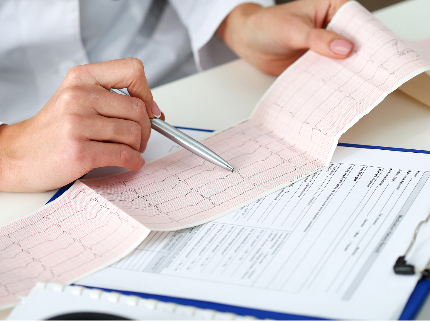Ein Arzt hält einen Stift und zeigt auf ein EKG-Diagramm, das vor ihm liegt.