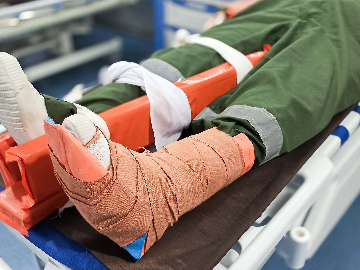Verletzte Beine eines Patienten, eines ist geschient, das andere hat einen Verband mit Stabilisierung.
