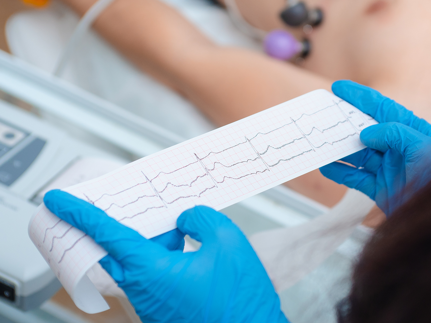 Eine Person mit blauen Handschuhen hält ein EKG-Diagramm, während im Hintergrund ein Patient auf einer Liege liegt.