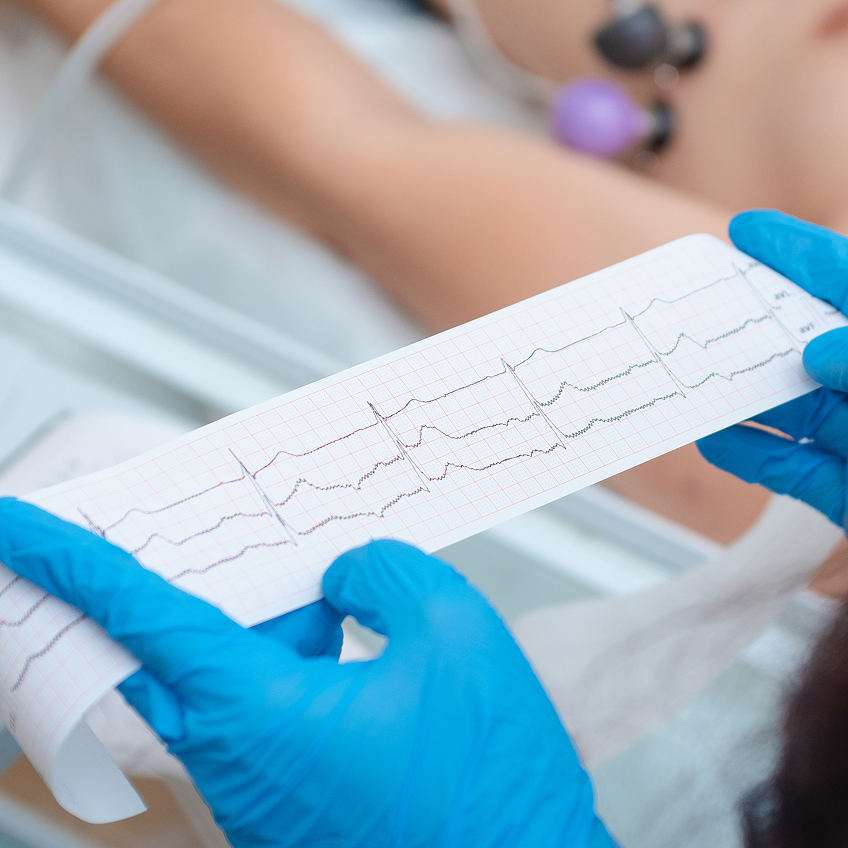 Eine Person mit blauen Handschuhen hält ein EKG-Diagramm in der Hand, während im Hintergrund ein Patient liegt.